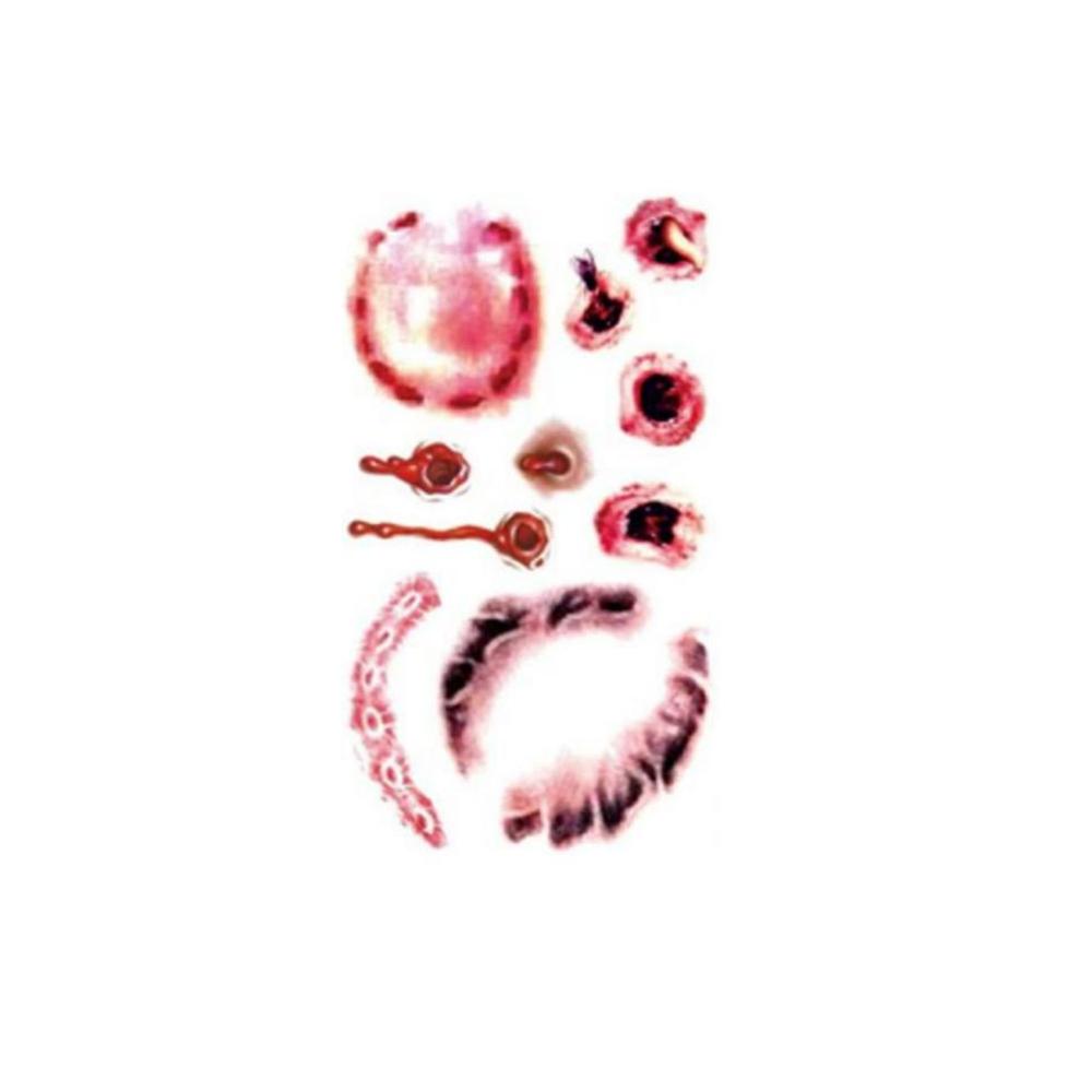 TattooHal